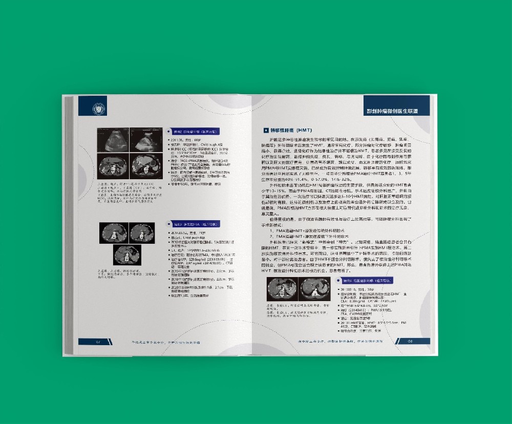 印刷過(guò)程中的色彩變化如何影響最終顏色模式的呈現(xiàn)效果？